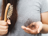 Chute de cheveux saisonnière : comment y faire face ?